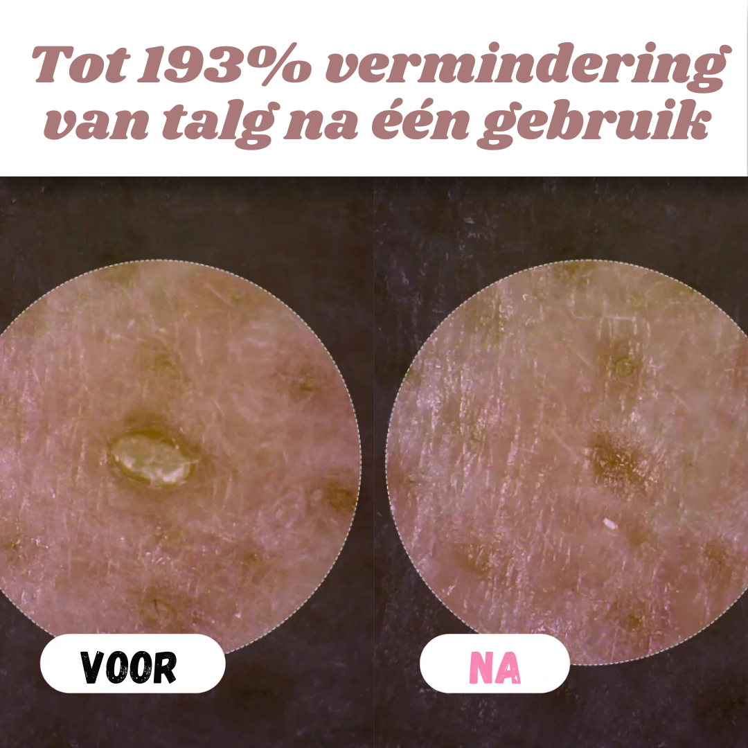 Peelshot™ | Duo Rijst Exfoliant Voor Stralende En Zuivere Huid