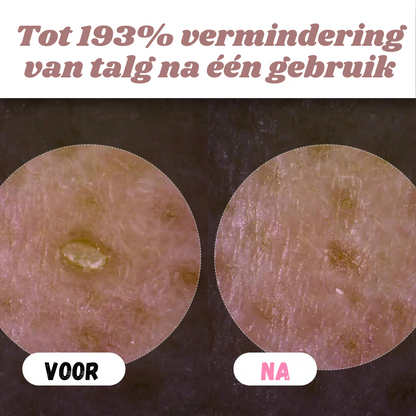 Peelshot™ | Duo Rijst Exfoliant Voor Stralende En Zuivere Huid