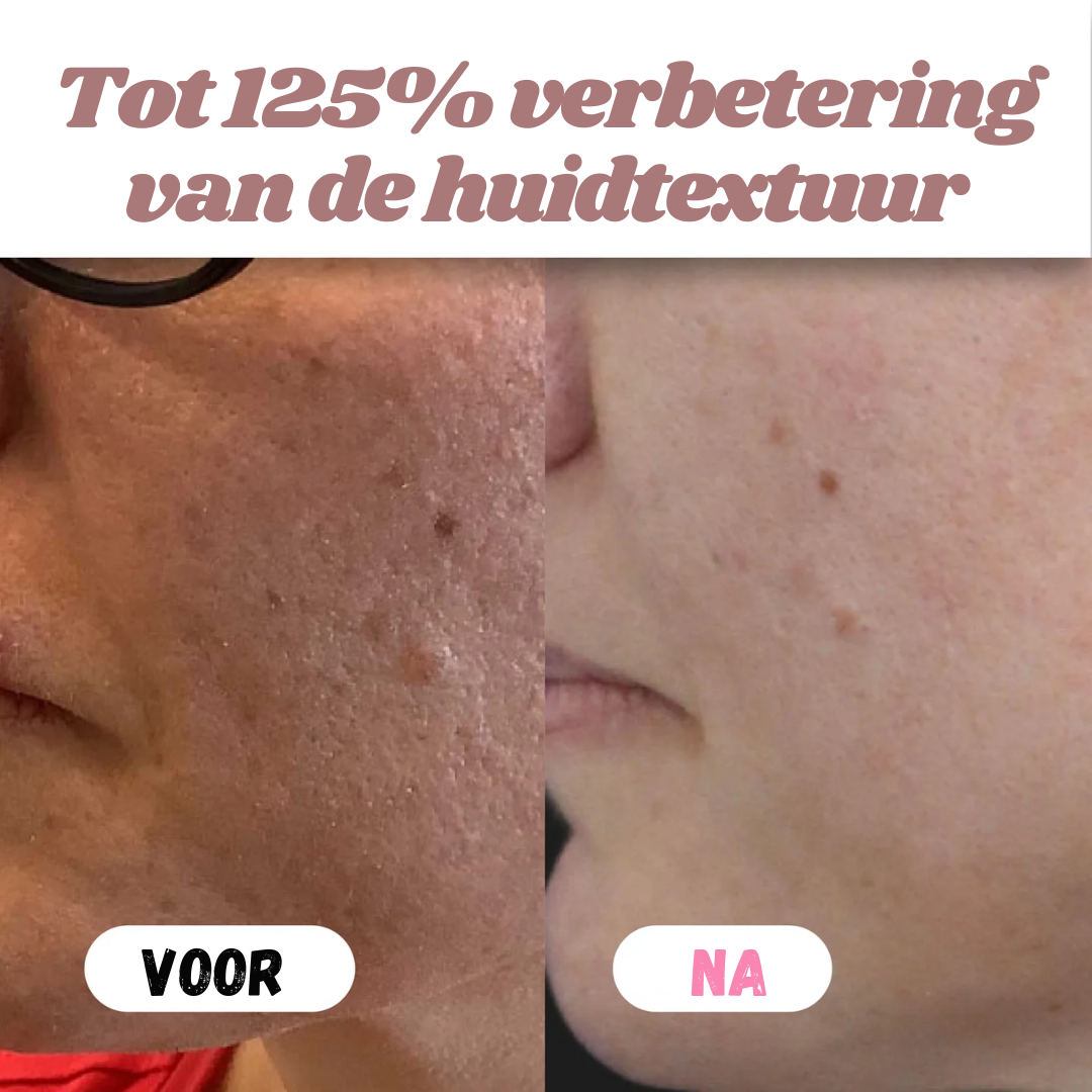 Peelshot™ | Duo Rijst Exfoliant Voor Stralende En Zuivere Huid