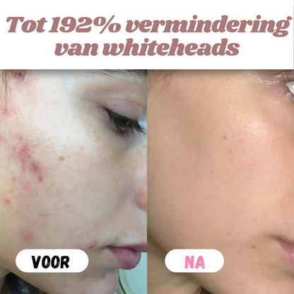 Peelshot™ | Duo Rijst Exfoliant Voor Stralende En Zuivere Huid