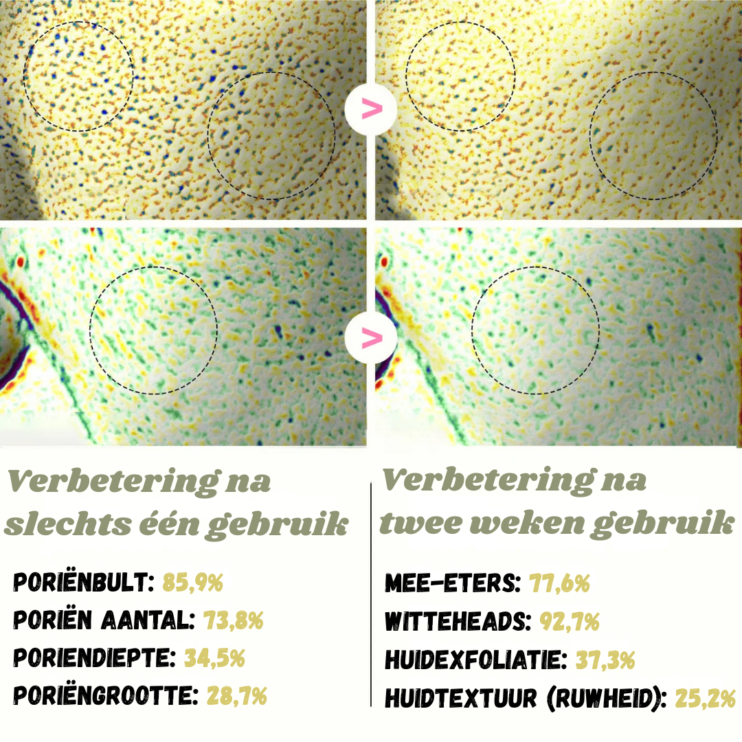 Peelshot™ | Duo Rijst Exfoliant Voor Stralende En Zuivere Huid