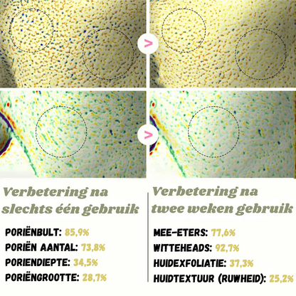 Peelshot™ | Duo Rijst Exfoliant Voor Stralende En Zuivere Huid